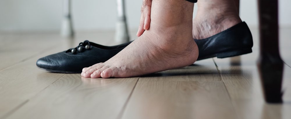 diabetic foot amputation