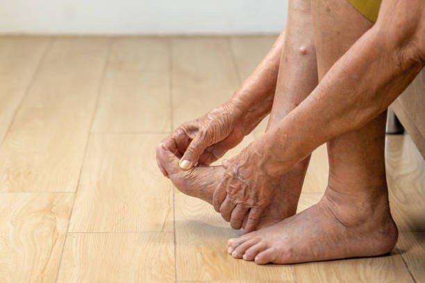 Most Common Aging-Associated Foot Problems and How to Manage Them